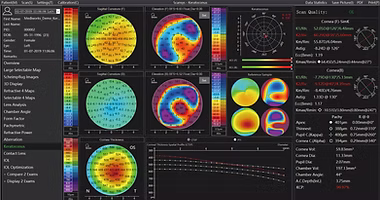 Diagnóstico de ceratocone com inteligência artificial